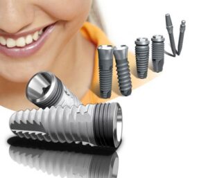 cay ghep implant tieu chuan quoc te